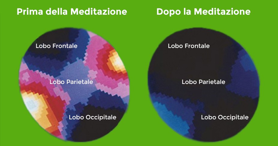 effetti-meditazione